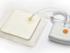 Для лечения каких ран применяется вакуумная терапия