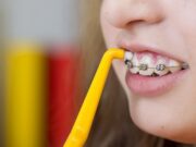 Кому рекомендовано применение многопучковых зубных щеток