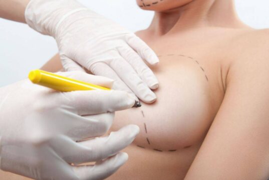 Кому показана редукционная маммопластика