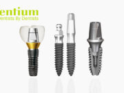 Южнокорейские импланты «Дентиум» – конструктивные особенности и используемые материалов
