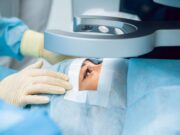 Хирургия катаракты: показания и особенности операции