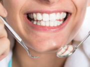 Восстановление зубов вкладками