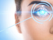 Лазерная коррекция зрения: плюсы и минусы