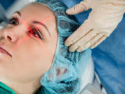 Лазерна корекція зору: кому знадобиться операція