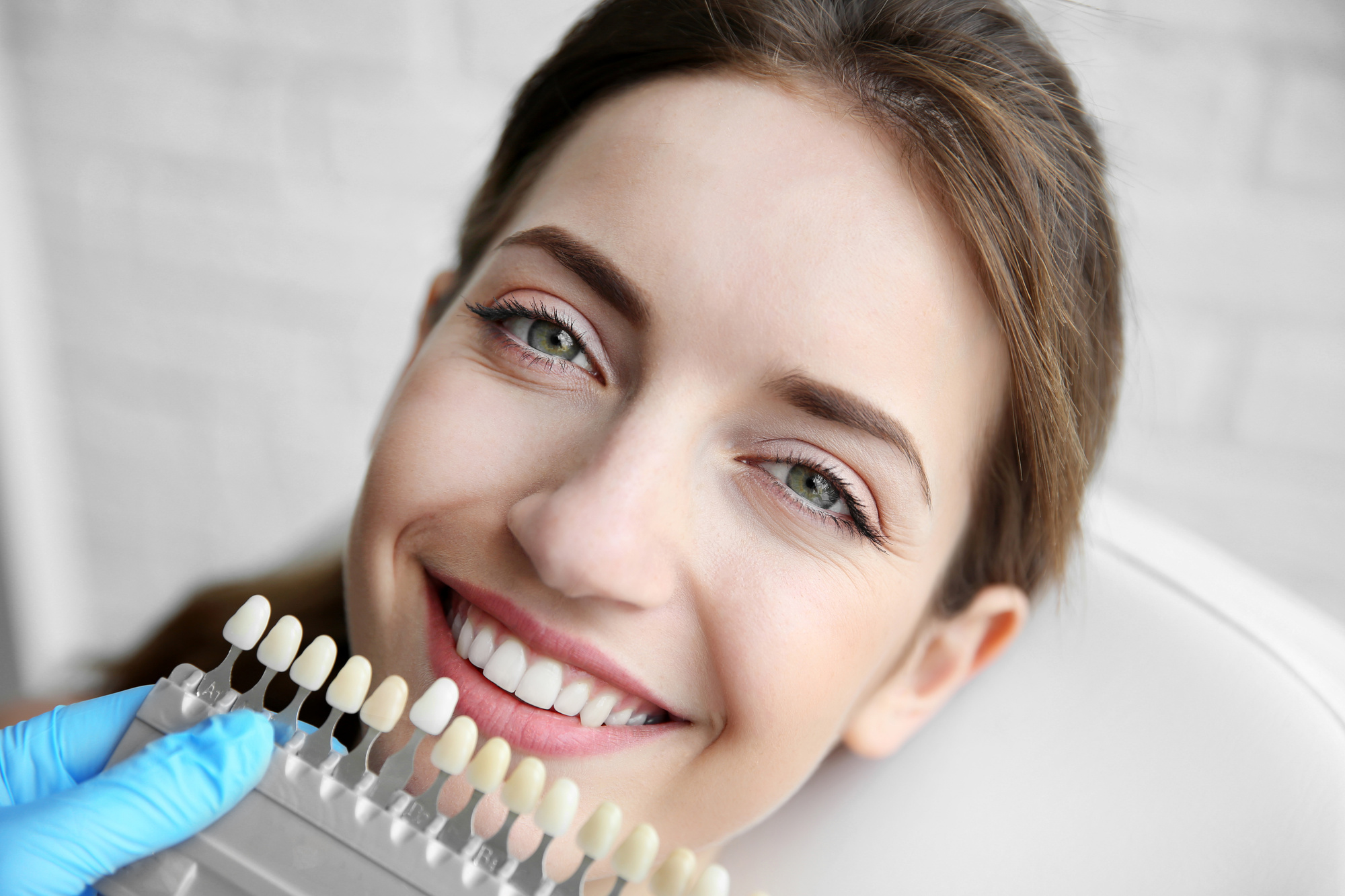 киров стоматология отбеливание зубов цены