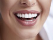 Отбеливание зубов: виды и описание