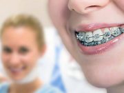 Как исправить прикус: полезные советы