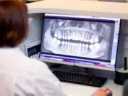 Томография зубов: подготовка к диагностике