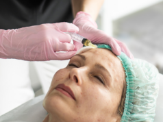 Плазмотерапия волосистой части головы