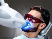 Особенности и виды профессионального отбеливания зубов