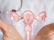 Подбор контрацепции: почему это должен делать только гинеколог