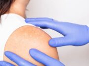 Роль дерматологии в современном мире