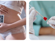 Что такое ЭКО: шанс на родительство