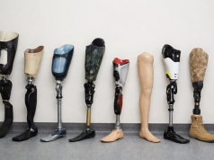 Как выбрать протез для нижней конечности